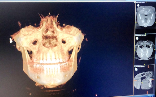 airway dentistry x ray