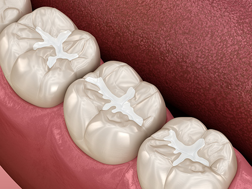 3d model of molars