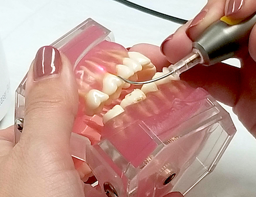 Demonstration of tooth cleaning on dental model