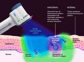 Fluorescence Visualization Diagram