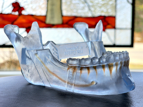 Acrylic Jaw model